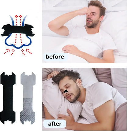 30/90/150, Anti Snoring Nose Patch Set Extra Strength Nasal Strips Better Breathing Non-Invasive Easier Breath Sleep Aid Decive